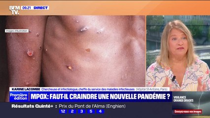 Mpox: quels sont les symptômes?