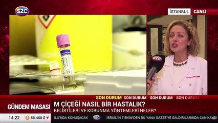 Maymun çiçeği nasıl bir hastalık?