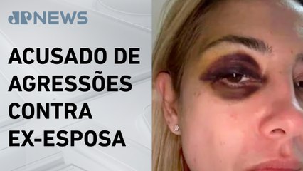 MP da Argentina pede indiciamento de Alberto Fernández