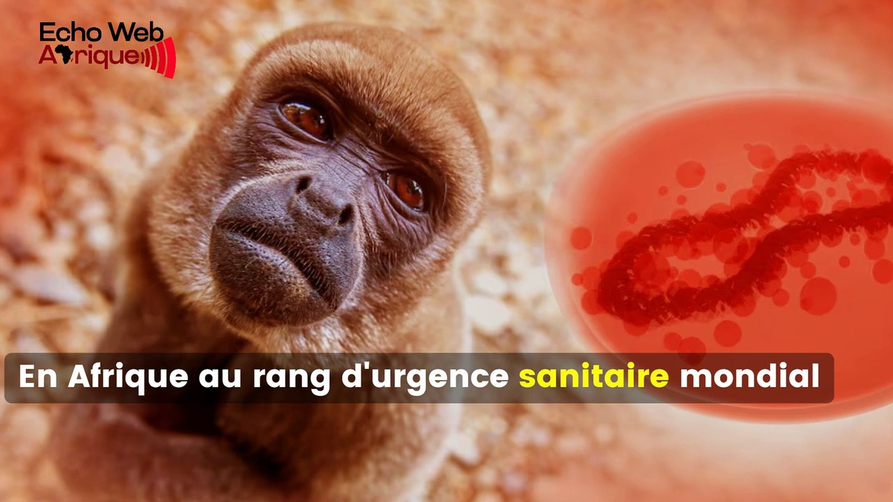 L’OMS déclare l’épidémie de MPOX comme une urgence sanitaire mondiale