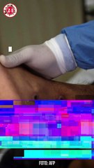 OMS emite alerta máxima por brote de viruela mpox