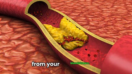 Top 6 Exercises to Lower High Cholesterol Naturally