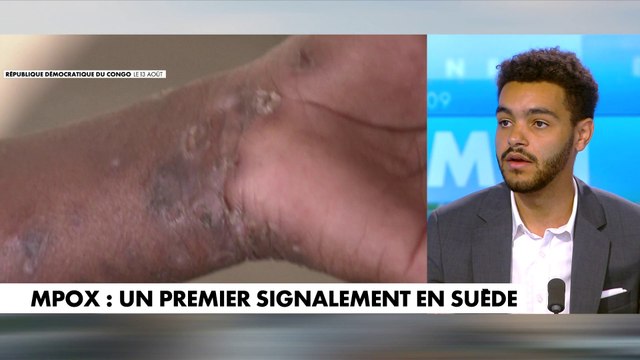 «Il faut fermer les frontières» pour empêcher l’importation du virus mpox selon le secrétaire général du groupe de réflexion Le Millénaire