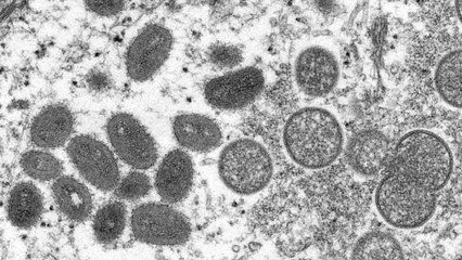 Mpox-Virus: Wie gefährlich ist die neue Bedrohung? ⚠️