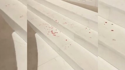 Bu görüntüler yakışmadı: Meclis'te kan izleri!