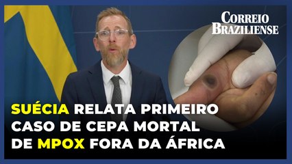 Suécia relata primeiro caso de cepa mortal de mpox fora da África