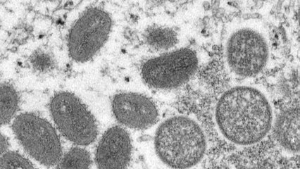 WHO "엠폭스 대처, 백신 접근성 중요...국경 봉쇄는 권장 안 해" / YTN
