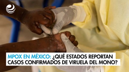 Mpox en México: ¿Qué estados ya reportan casos confirmados de viruela del mono?