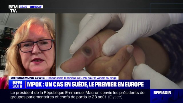 Rosamund Lewis (responsable technique à l'OMS pour la variole du singe): Il n'y a pas un risque accru pour la population générale