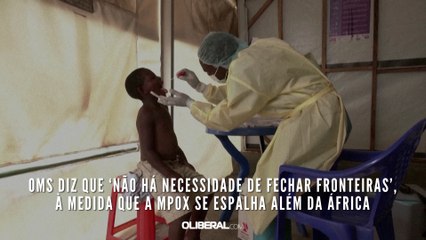 OMS diz que ‘não há necessidade de fechar fronteiras’, à medida que a mpox se espalha além da África