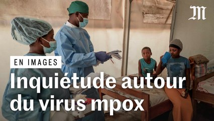 L’inquiétude monte autour de la propagation du virus mpox