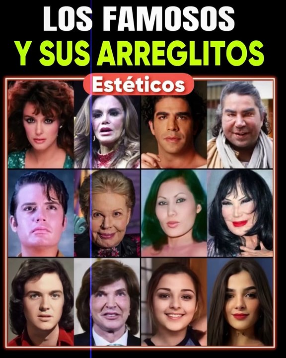 LOS FAMOSOS Y SUS ARREGLITOS ESTÉTICOS ‍