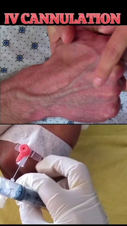 How to insert cannula in vain?|IV cannula|चतुर्थ प्रवेशनी|قنية IV|#viral#shorts#Cannula#DrSadia1446