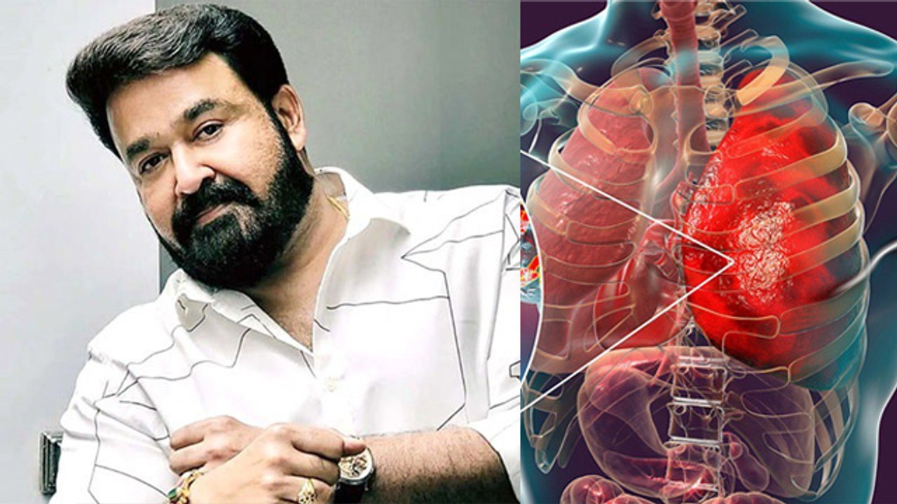 South Actor Mohan Lal Hospitalised Reason, Viral Respiratory Infection Causes, Symptoms & Treatment