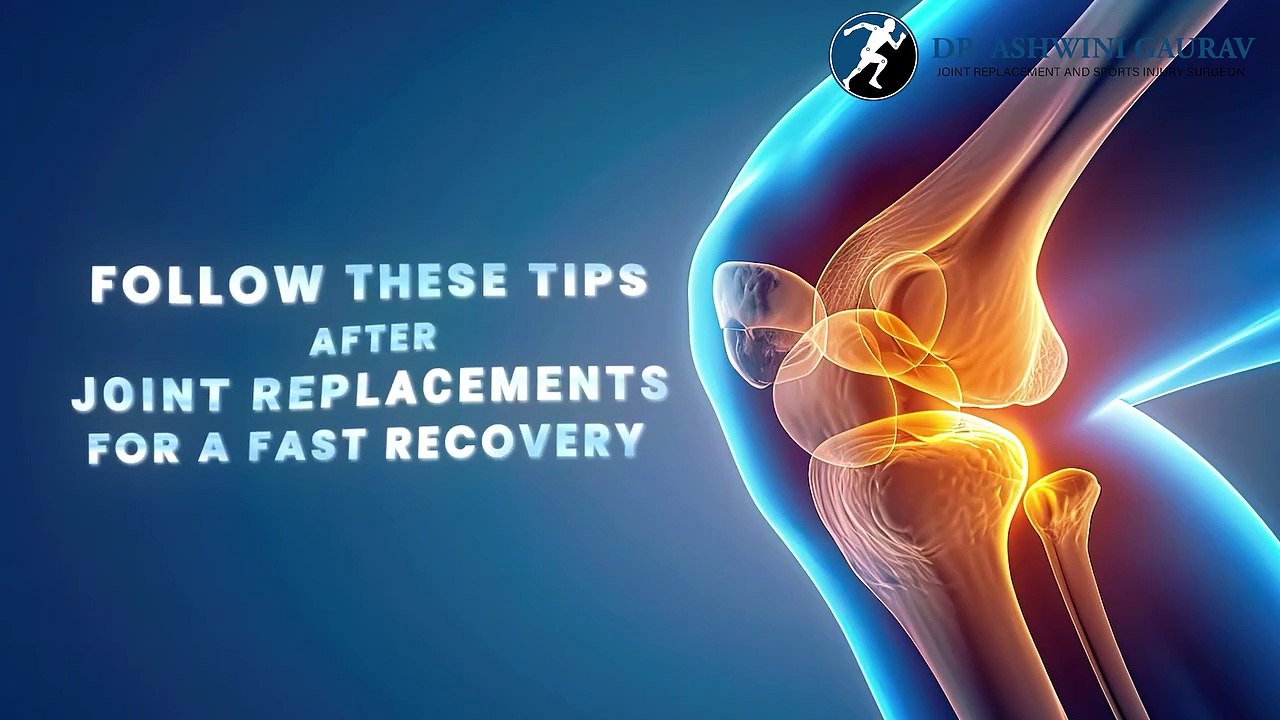 Do These Things After Joint Replacement For Fast Recovery