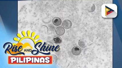 Video herunterladen: Bagong kaso ng mpox sa bansa, kinumpirma ng DOH; Surveillance, detection, at contact tracing, pinaigting