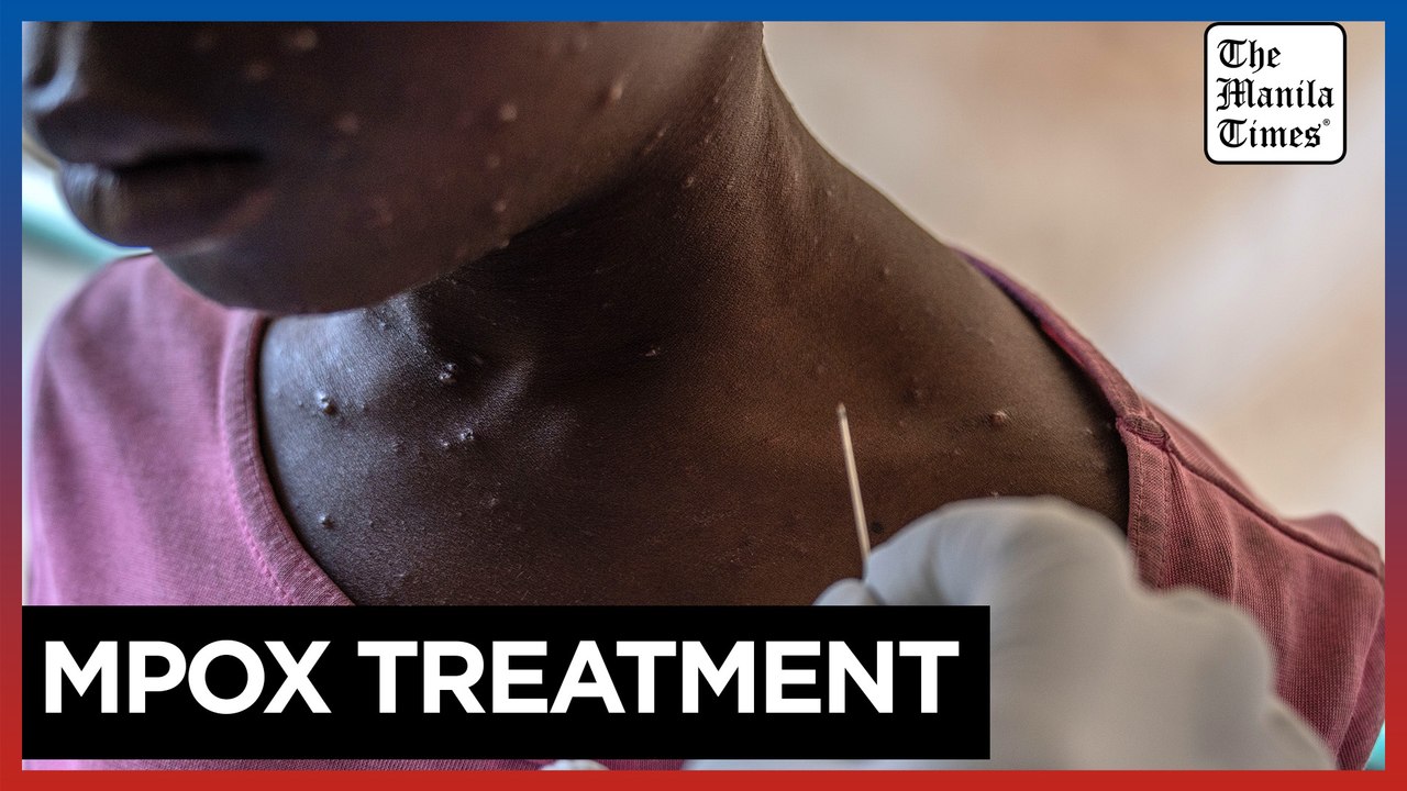 Mpox patients receive treatment in Munigi