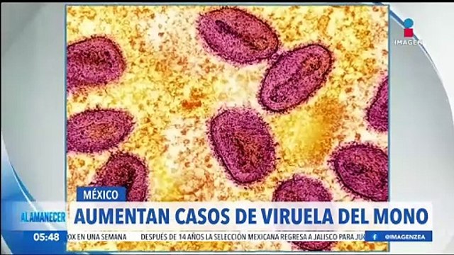 Aumentan los casos de mpox (viruela del mono) en México