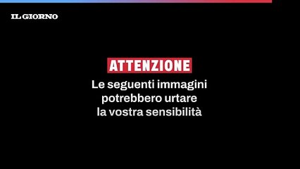 Pioltello: ragazzo investito da un "pirata", si cerca un'auto bianca