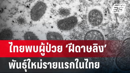 ไทยพบผู้ป่วย ‘ฝีดาษลิง’ พันธุ์ใหม่รายแรกในไทย เดินทางจากคองโก! | จับข่าวคุย | 21 ส.ค. 67