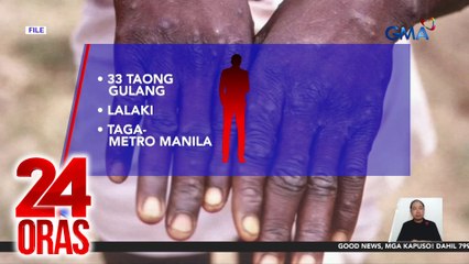 33-anyos na mpox patient, nag-41 close contacts sa spa at derm clinic sa Q.C.,  28, mataas ang tsansang mahawa | 24 Oras