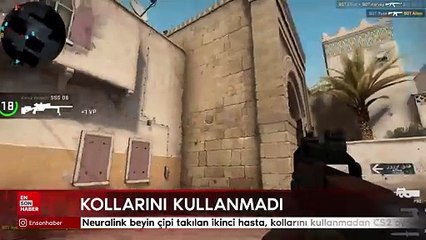 Neuralink beyin çipi takılan ikinci hasta, kollarını kullanmadan bilgisayar oyunu oynadı