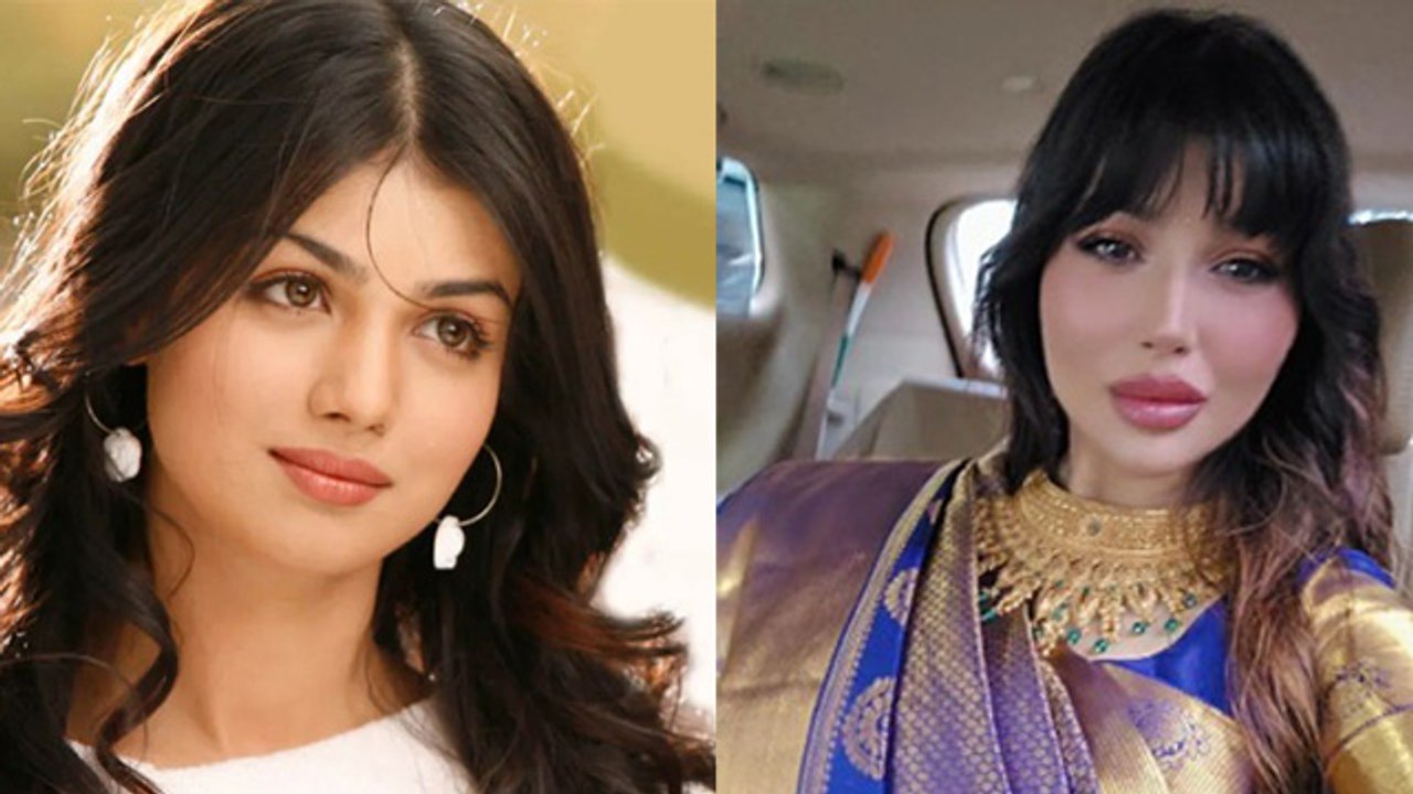 Ayesha Takia New Look After Plastic Surgery Video, Kylie Jenner से Compare कर Fans Troll|Boldsky