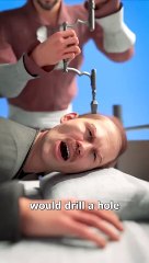 Drilling A Hole In Your Head  #facts #weird #sciencefacts Do Ear Candles Really Work  #facts #weird #USA #Canada #Viral #Famous #trending #UniqueVideo #Viralclips #germany