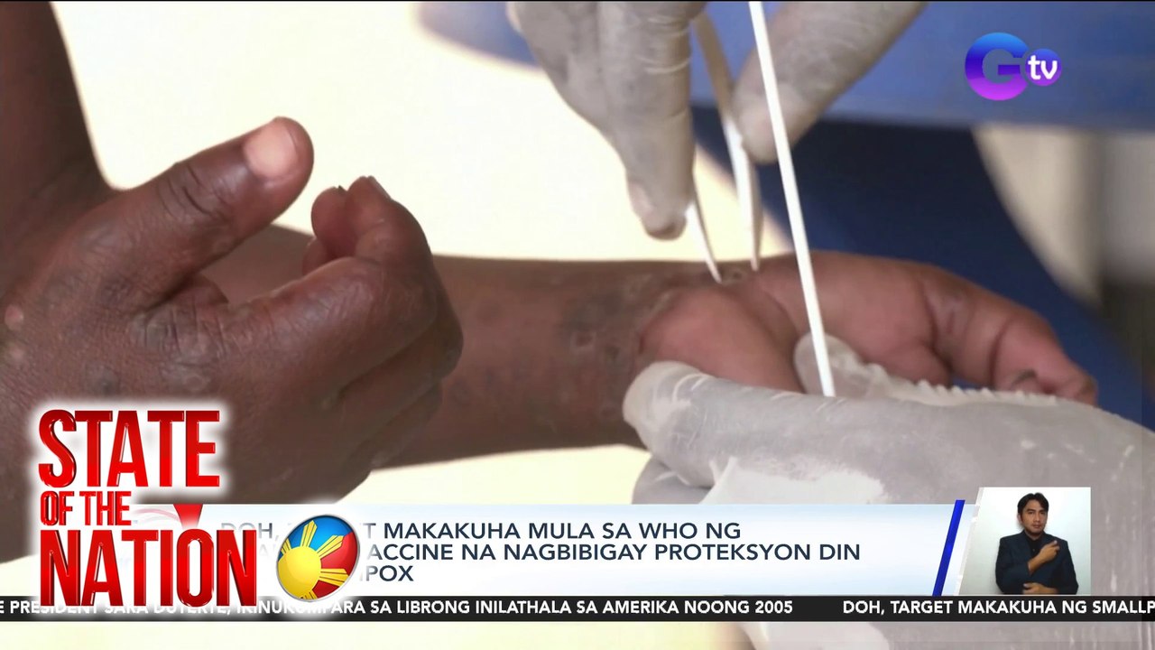 DOH, target makakuha mula sa WHO ng smallpox vaccine na nagbibigay proteksyon din laban sa Mpox | SONA