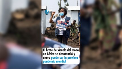 El brote de viruela del mono en África se desatendió y ahora puede ser la próxima pandemia mundial