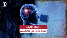 «الحالة الثانية» .. شريحة جديدة في مخ إنسان