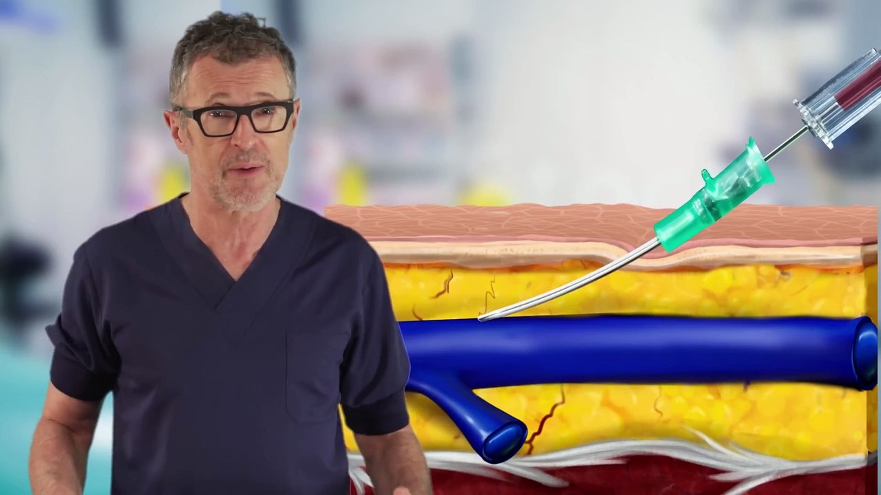 erreurs de canulation intraveineuse