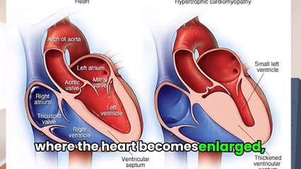 The Different Types of Cardiovascular Diseases Explained.
