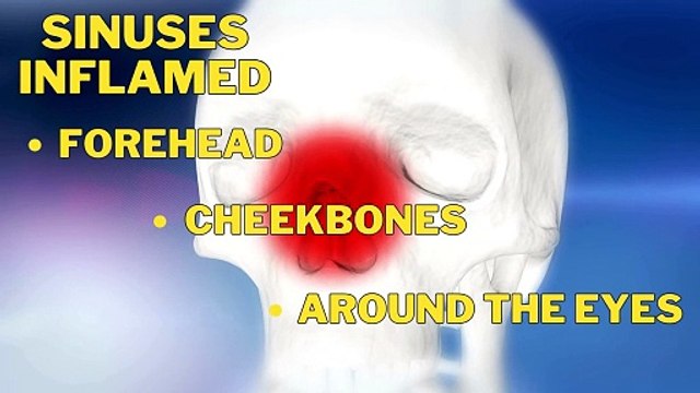 Understanding Headaches: Types, Causes, and Effective Treatments