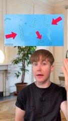 Filaments devant vos yeux : Qu'est-ce que c'est et comment les gérer ? 👀