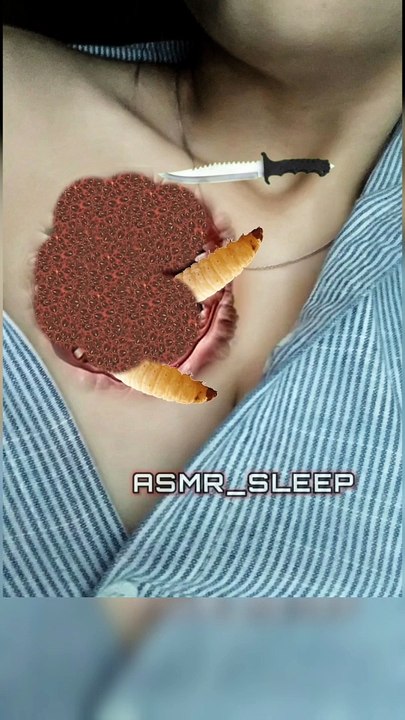 girl maggot's removal asmr animation #asmr