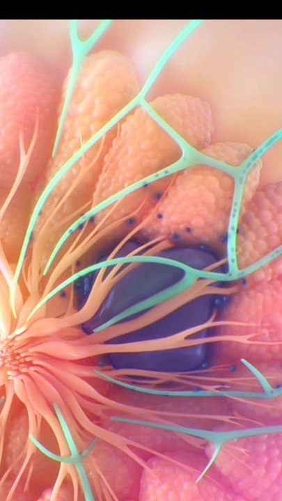 Breast Cancer |Causes of breast cancer| أسباب الإصابة بسرطان الثدي|स्तन कैंसर के कारण |#viral #shorts #dailymotionshorts #short #shortsfeeds  #DrSadia1446