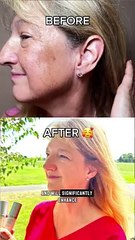 Genix Bundle: Placenta Extract Face and Eye Cream