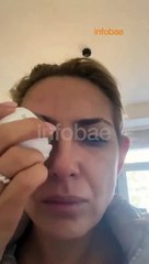 Fabiola Yañez presentó nuevas imágenes con golpes