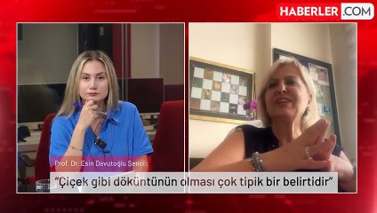 Prof. Dr. Esin Davutoğlu Şenol: Maymun çiçeği virüsü çocuklarda, bağışıklık sistemi baskılanmış olanlarda ve gebelerde ölümcül seyrediyor