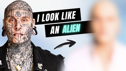 My Entire Face & Body Are Tattooed - Until Today | TRANSFORMED