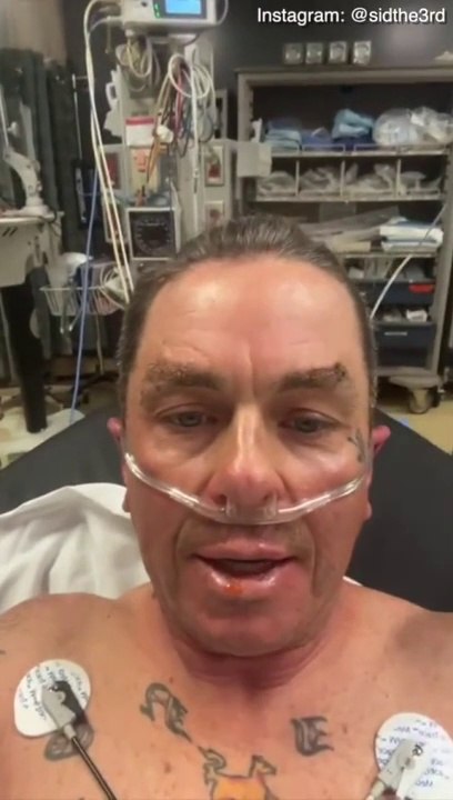 Slipknot's Sid Wilson treated for serious burns after explosion