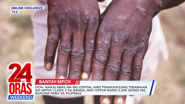 ONLINE EXCLUSIVE: DOH: Nakalabas na ng ospital ang pinakahuling tinamaan ng MPOX Clade 2 sa bansa; may offer nang 2,000 doses ng bakuna para sa Pilipinas | 24 Oras Weekend