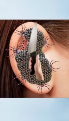 ASMR Bujh lam na Infected treatments Ear video Ani_ ASMR animation treatment _Amar_Asmr595(720P_HD)