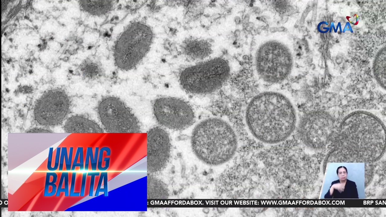 DOH – Pasyenteng tinamaan ng mpox, nakalabas na sa ospital | Unang Balita