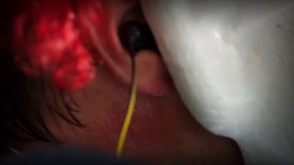 Hear Me Episode 1 | Hindi/Urdu Dubbed - Meet the Characters in a Turkish Town 🎬