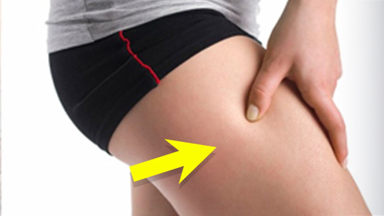 Meralgia Paresthetica Causes & Treatment: Thigh Me Jhanjhanahat Reason In  Hindi