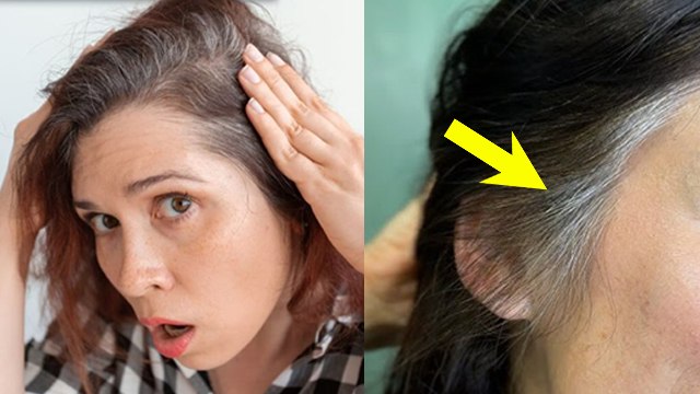 Which Vitamin Deficiency Causes White Hair: Kis Vitamin Ki Kami Se Baal Safed Hote Hain ?