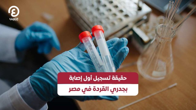 حقيقة تسجيل أول إصابة بجدري القردة في مصر