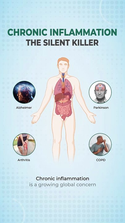 Chronic Inflammation: The Silent Killer #advancells #alzheimer #parkinson